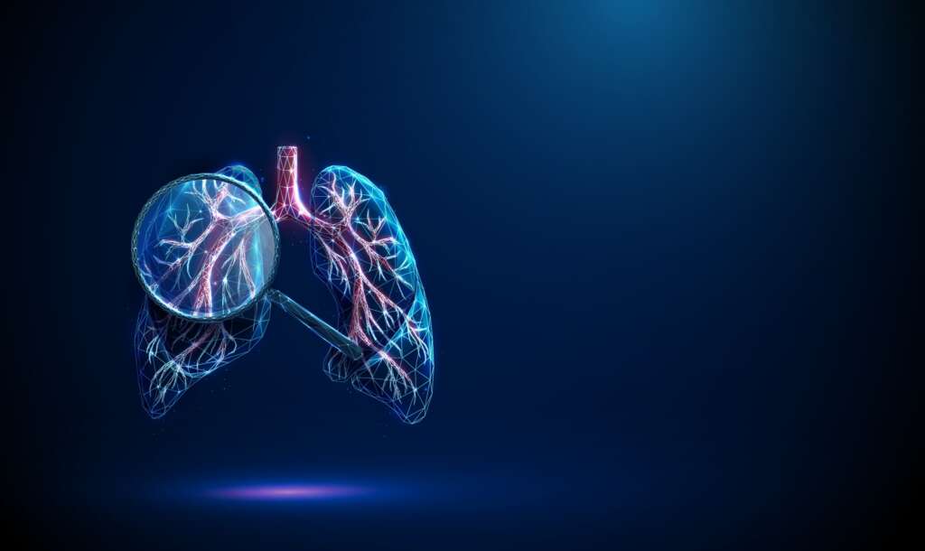 4DX plans to expand into the CTPA scan market following recent FDA clearances and growing US hospital adoption.